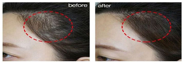 SEVICH - Haaransatz Puder                - Makeup für Ihre Kopfhaut