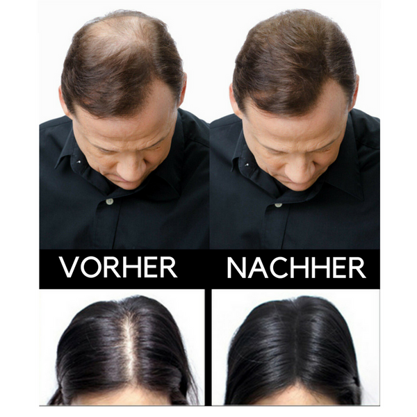 SEVICH - Streuhaar–Schütthaar–Haarverdichtung–Haarauffüller / Haarfasern